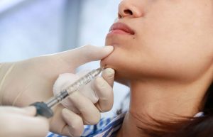 dermal fillers treatment
