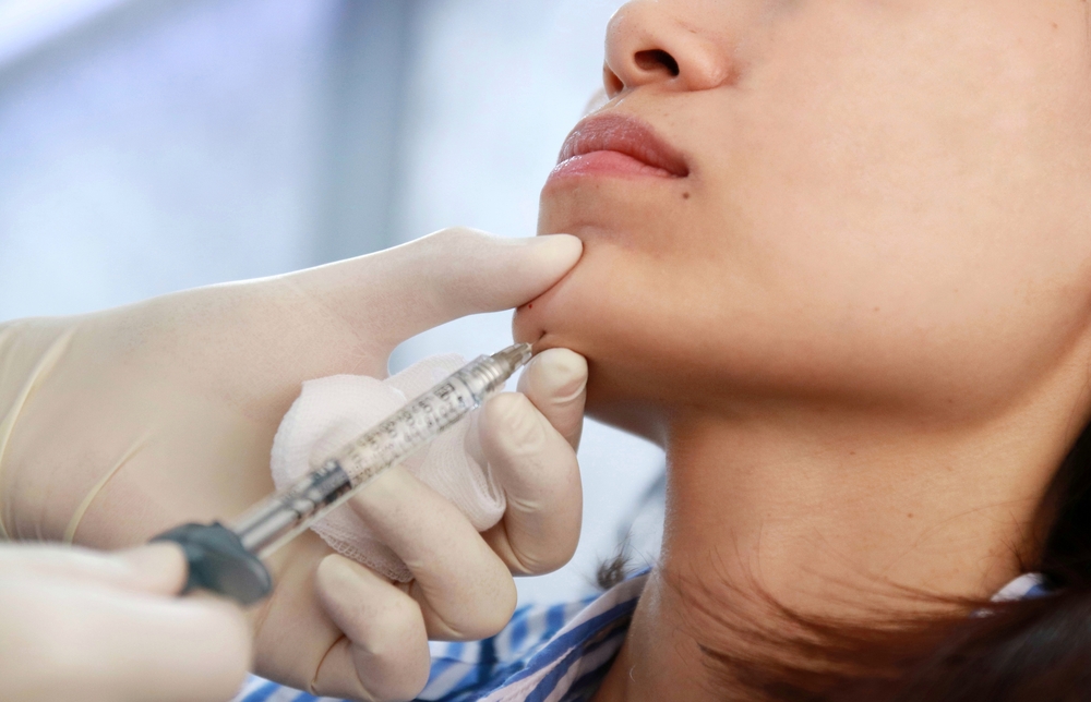 dermal fillers treatment