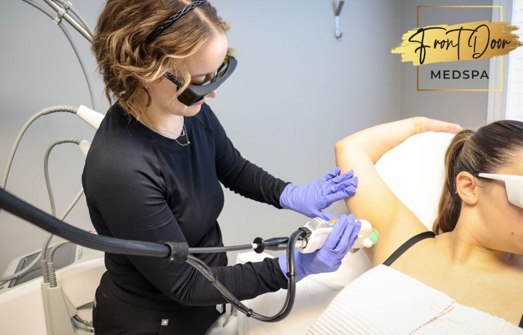 laser hair removal