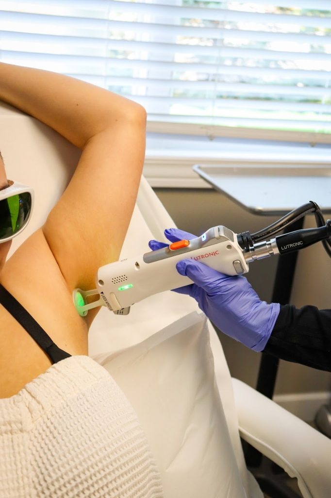 armpit laser hair removal