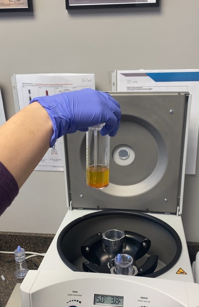 PRF Coming Out of Centrifuge