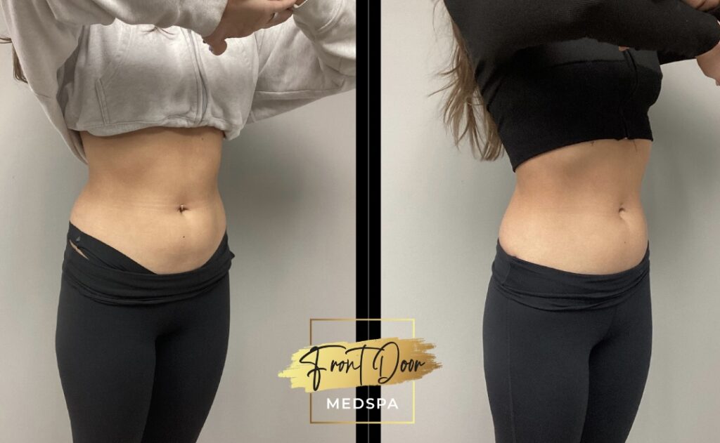 female adb obligue 2